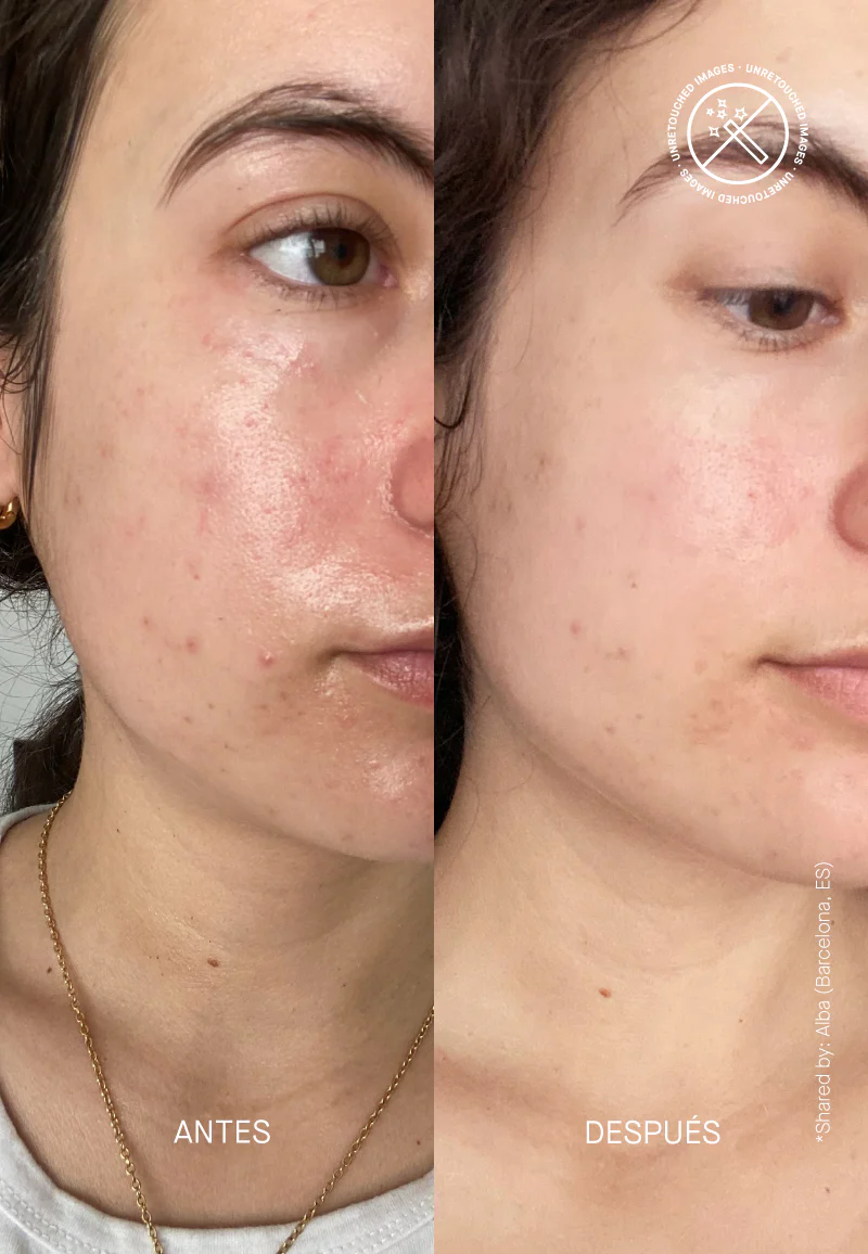 Barrier Restoring Hydrating Cream - Image 8